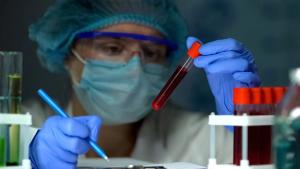 The FDA has granted orphan drug designation to zavabresib, an investigational therapy for the treatment of myelofibrosis, a rare blood cancer: © stock.adobe.com.