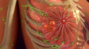 Adding Tukysa to Regimen for Metastatic HER2-Positive Breast Cancer Does Not Decrease Quality of Life