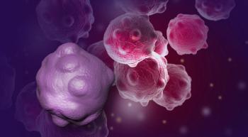 Image of breast cancer cells.