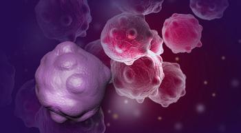 Illustration of breast cancer cells.