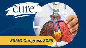 lung cancer image
