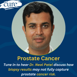 Biopsy Alone May Miss Risk in Grade Group 1 Prostate Cancer