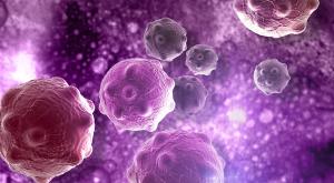 Orca-T Improves Post-Transplant Survival in Patients With Blood Cancers