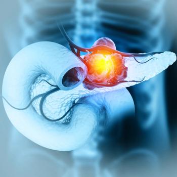 CM24 plus Opdivo and chemo improved survival in pancreatic cancer with CEACAM1 biomarkers, supporting a biomarker-driven phase 2b study: © stock.adobe.com.