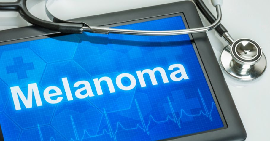 Experts Give an Overview of the Latest Melanoma Therapies