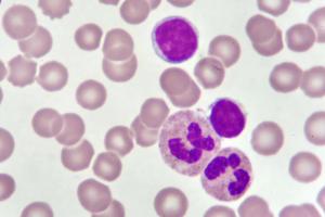 CLL