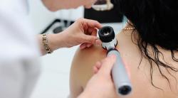 Longer Time Until Recurrence Associated With Better Melanoma Outcomes