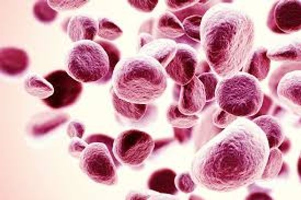 Image of Myeloma