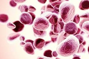 Image of Myeloma