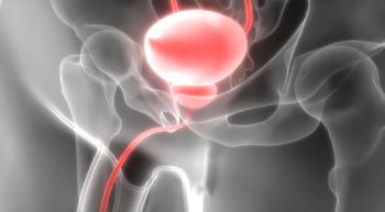 bladder cancer image