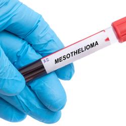 FDA Grants Orphan Drug Status to VT3989 for Mesothelioma Treatment