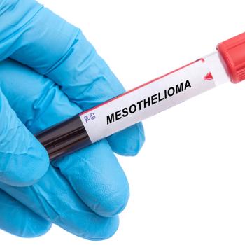 The FDA awarded orphan drug designation to VT3989 for mesothelioma: © stock.adobe.com.