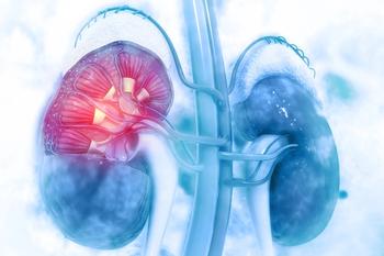 Illustration of kidneys with a tumor on one.