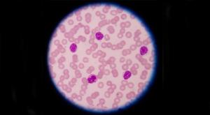 The Best Policy to Eliminate Barriers to Care