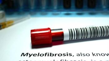 myelofibrosis