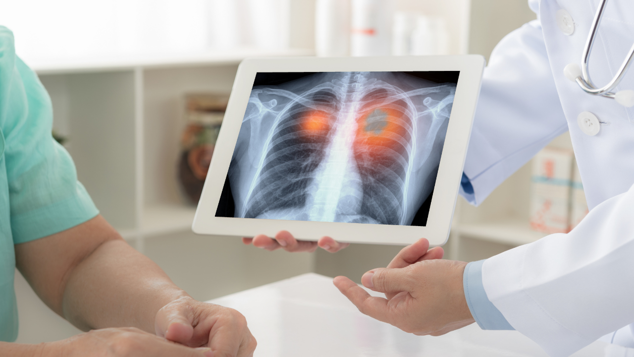 Early trial data suggest Olvi-Vec may shrink or control cancer after platinum therapy: © stock.adobe.com.