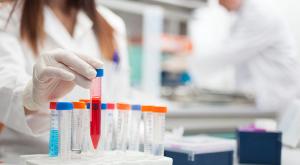 Ojemda Shrank Tumors in 43% of Patients With Rare BRAF, CRAF Changes