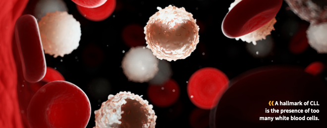 Chronic Lymphocytic Leukemia