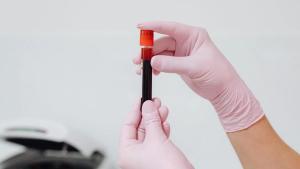 blood test