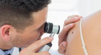 skin cancer screening