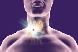 Retevmo Is ‘Very Exciting’ for Some with Advanced Thyroid Cancer