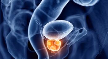 Illustartion of prostate.