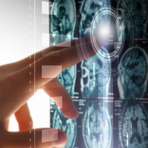 Trying the "Kitchen Sink" to treat Brain Cancer