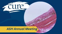 Odronextamab Plus CHOP Shows Early Efficacy in DLBCL