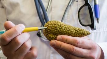 image of pancreatic cancer