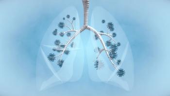Illustration of tumors in both lungs. 