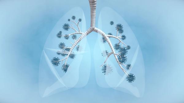 lung cancer