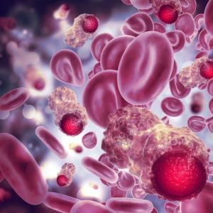 A patient with relapsed follicular lymphoma achieved complete remission one month after PMB-CT01 treatment: © stock.adobe.com.