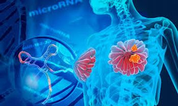 Presurgical Keytruda Plus Chemotherapy Improves Response for Some With Breast Cancer