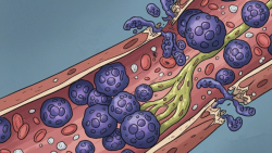 New Drug Combo Shows Deeper Responses in Multiple Myeloma