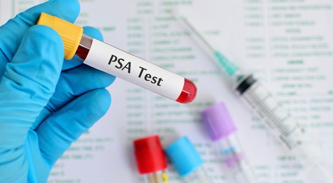 Gloved hand holding a test tube that reads, "PSA Test"