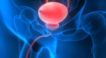 Image of bladder cancer.