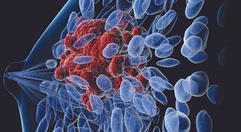 Illustration of breast cancer cells.