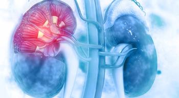 Illustration of kidneys with tumors in one kidney.