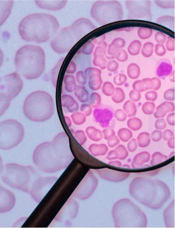 microscope looking at minimal residual disease