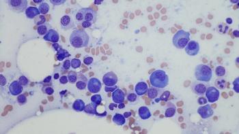multiple myeloma