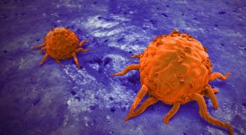 Image of multiple myeloma cells.