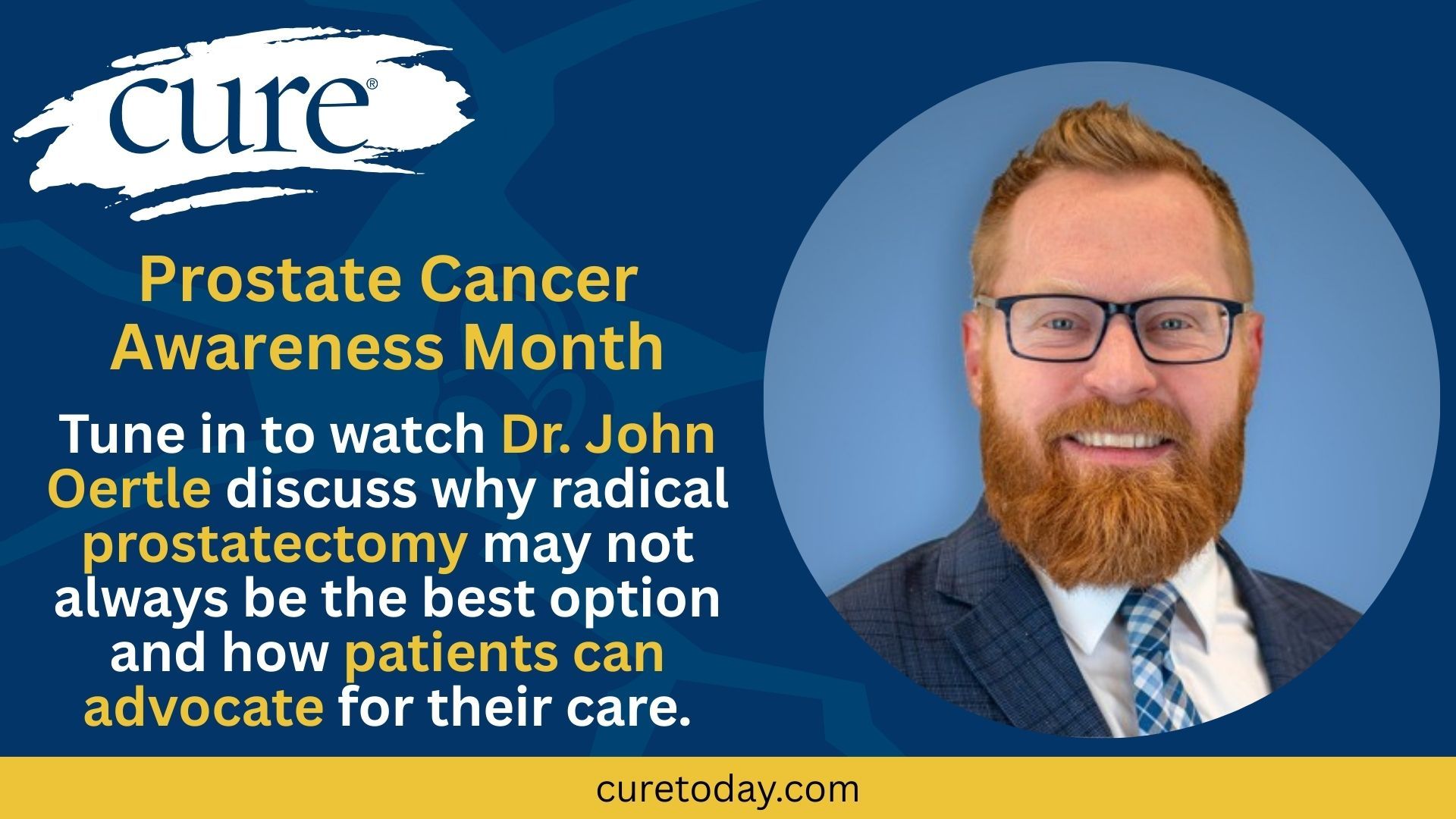 Understanding Prostate Cancer Surgery and Highlighting Patient Advocacy