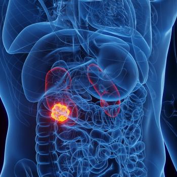 CURE spoke with the principal investigator of a clinical trial evaluating a therapeutic vaccine in advanced kidney cancer: © stock.adobe.com.