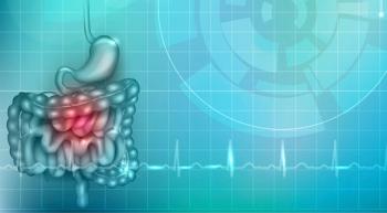abstract colorectal cancer
