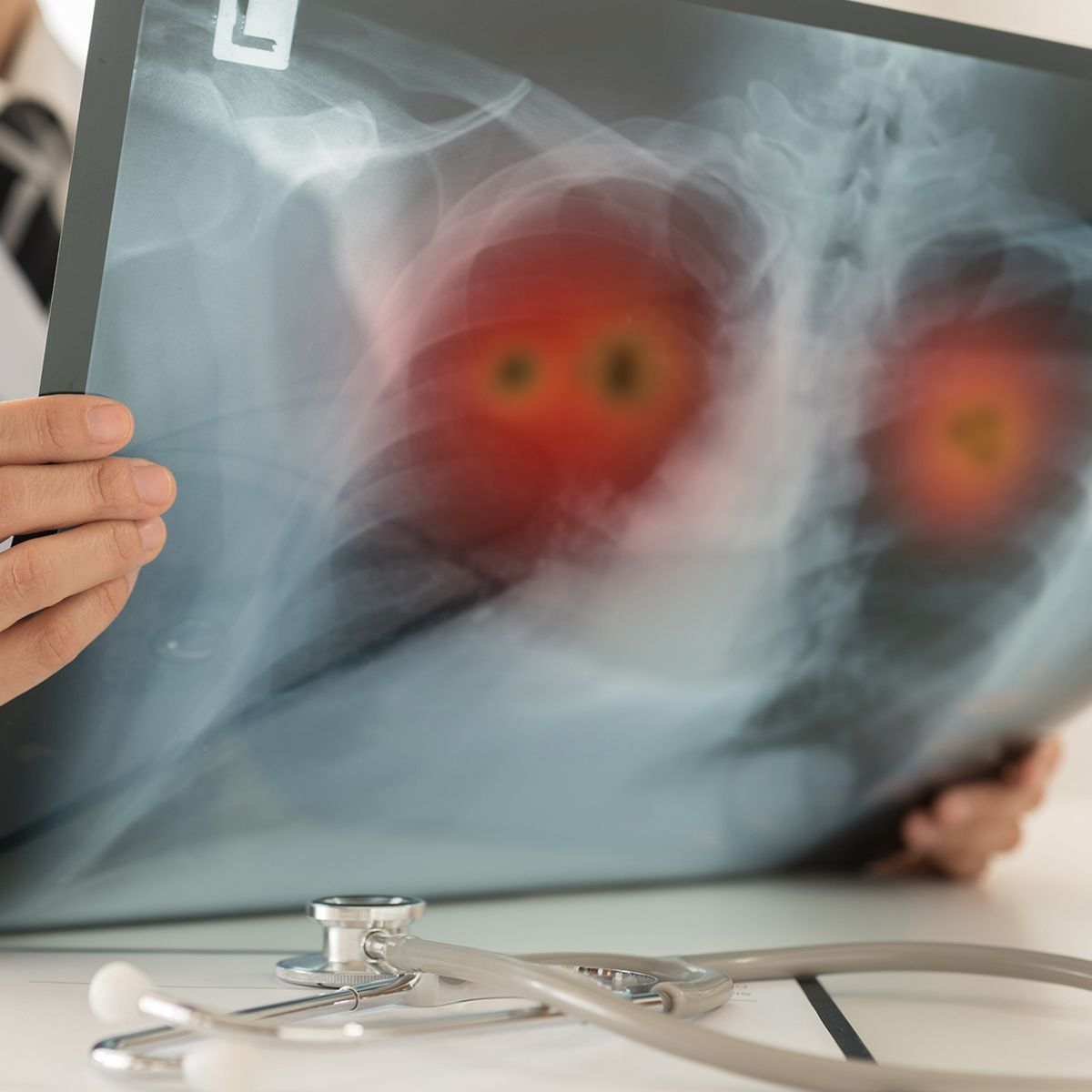 Lung Cancer Initiative has appointed Neal Ready, MD, PhD, as its first Chief Scientific Officer: © stock.adobe.com.