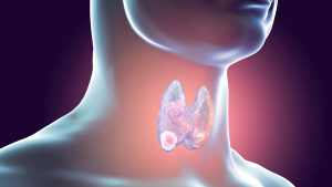 throat cancer