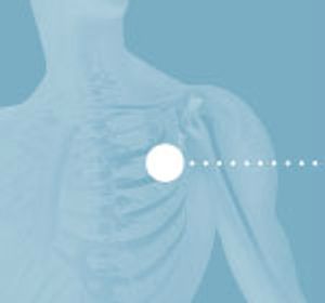  Medicare Begins Coverage of Lung Cancer Screening for High-Risk Individuals