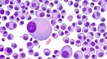 image of multiple myeloma