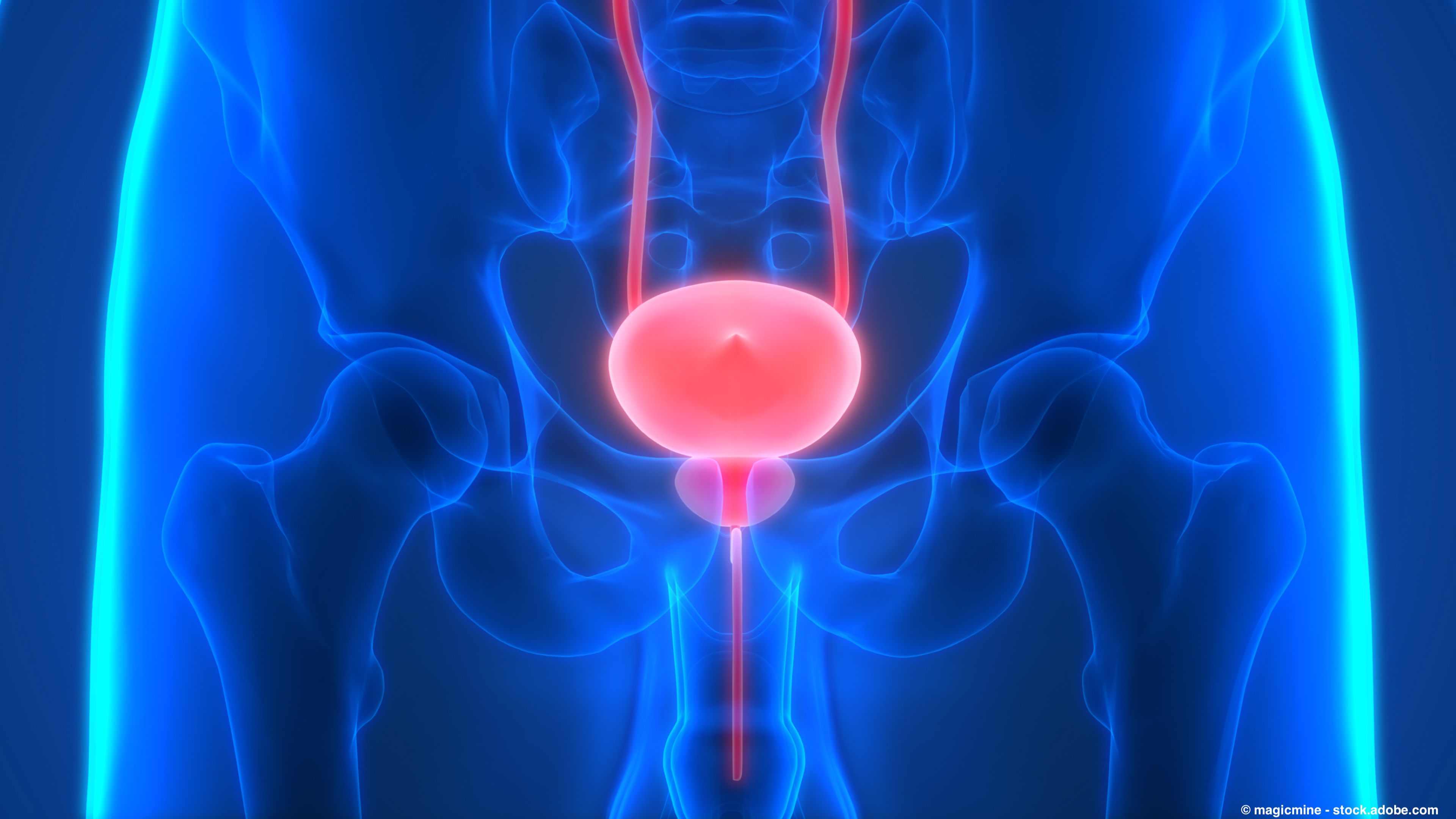 Certain side effects following enfortumab vedotin associated with improved PFS in metastatic urothelial carcinoma: © magicmine - stock.adobe.com