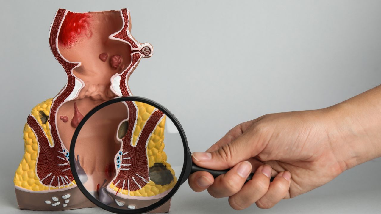 A diagnosis of anal cancer can feel overwhelming, but understanding the disease is the first step toward effective management and recovery: © stock.adobe.com.